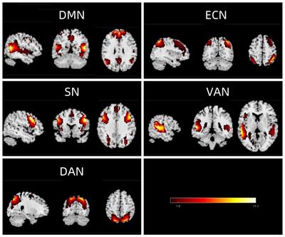 Resting-state brain networks alterations in adolescents with Internet Gaming Disorder associate with cognitive control impairments